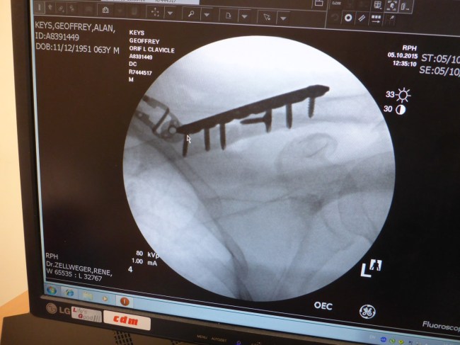 Pinned and plated. How it looks inside.